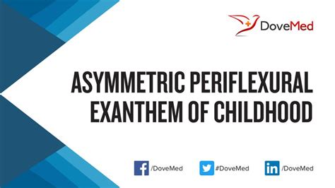 Asymmetric Periflexural Exanthem Of Childhood