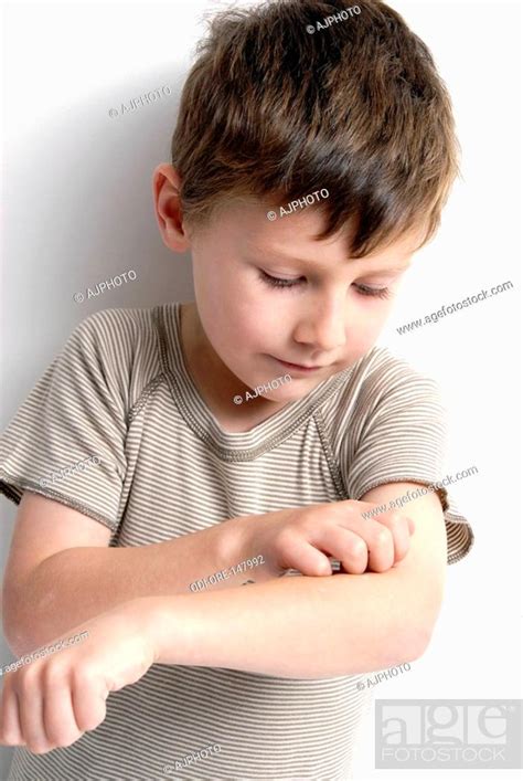 Child Itching Stock Photo Picture And Rights Managed Image Pic Odi