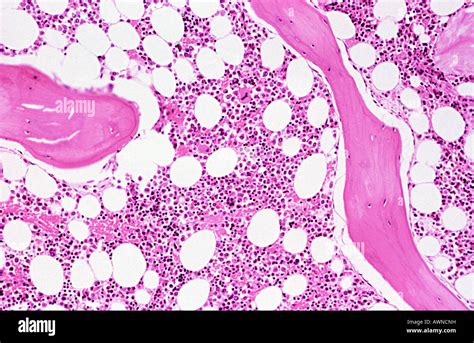 Histology Bone Marrow Hi Res Stock Photography And Images Alamy