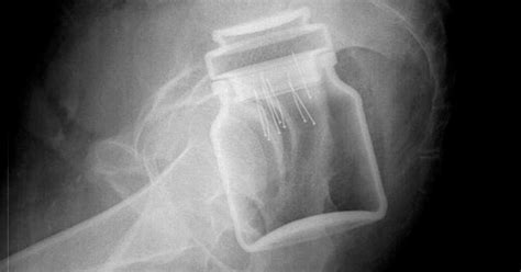 X Rays Of Objects Inside People Mirror Online