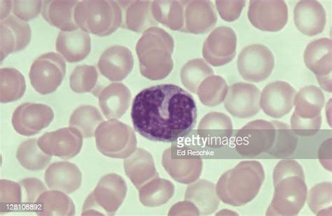 Monocyte Red Blood Cells Phagocyte Converted To Macrophage 500x Stock