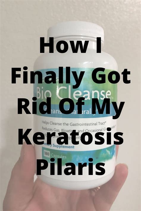 How To Get Rid Of Keratosis Pilaris Simply Noel Blog Artofit