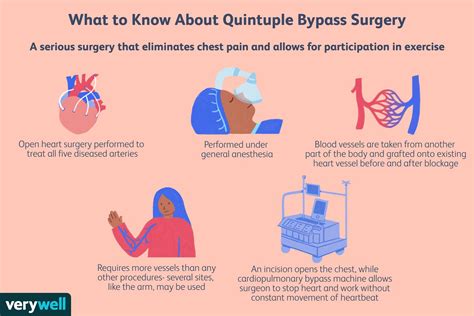 Quintuple Bypass Surgery Uses Procedure Recovery