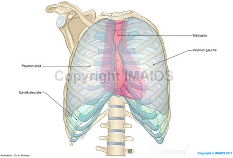 La plèvre pariétale lors d'un pneumothorax, une bulle vient percer la paroi du poumon et la plèvre viscérale. Anatomie du thorax et des poumons : Illustrations