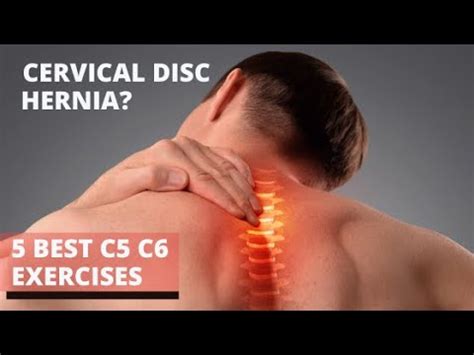 4 Best Cervical Disc Herniation Exercises C5 C6 Neck Pain Exercises