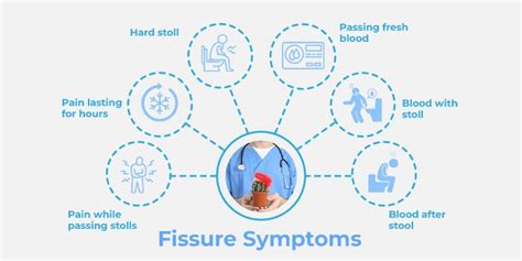 Fissure Treatment In Hyderabad
