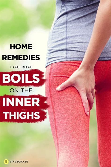 12 Home Remedies To Get Rid Of Boils On The Inner Thighs Skin Boil