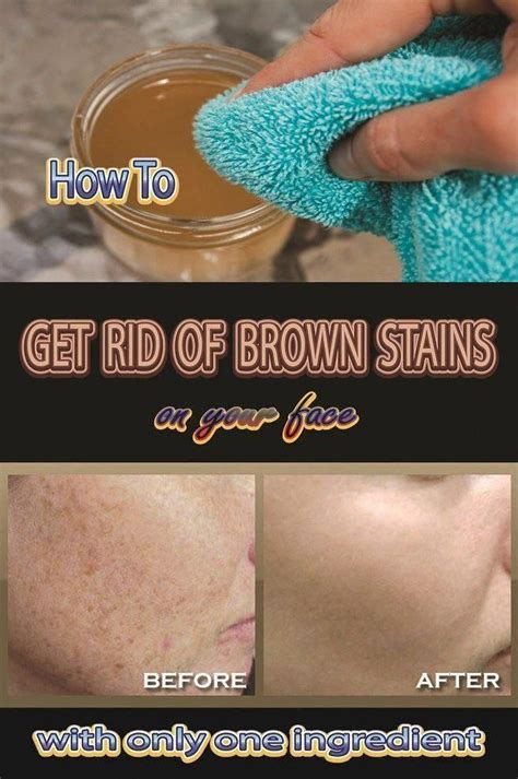 The Way To Remove Brown Spots On Encounter Normally
