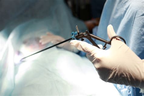 Laparoscopy A Minimally Invasive Intervention To Examine A Uterine