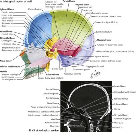Head And Neck Radiology Key