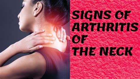 Signs Of Arthritis Of The Neck⚠️arthritis Symptoms⚠️arthritis Early Signs Youtube