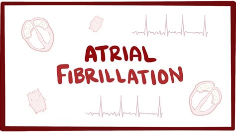 Atrial Fibrillation Video Anatomy And Definition Osmosis