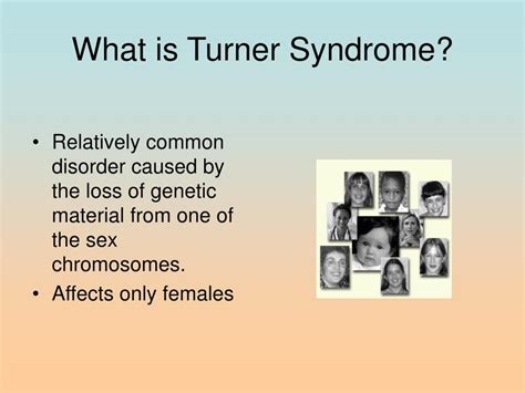 Ppt Turner Syndrome Powerpoint Presentation Free Download Id200179