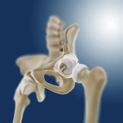 Hip Socket Anatomy Photograph By Springer Medizin Fine Art America