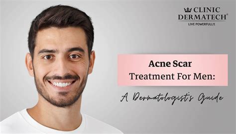 Acne Scar Treatment For Men A Dermatologists Guide Clinic Dermatech