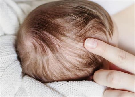 When To Be Concerned About The Soft Spot On Your Babys Head