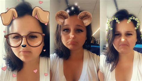 People Are Actually Getting Plastic Surgery To Look Like Snapchat Filters