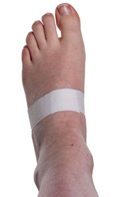 Turf toe most commonly affects athletes playing on rigid surfaces such as artificial turf e.g. Turf Toe Taping | Physical Sports First Aid Blog