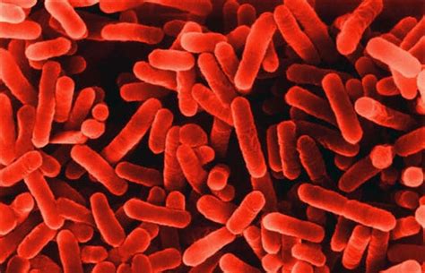 Legionella pneumophila is a gram negative, strictly aerobic bacterium of the. Legions of Legionella Bacteria - Woods Hole Oceanographic ...