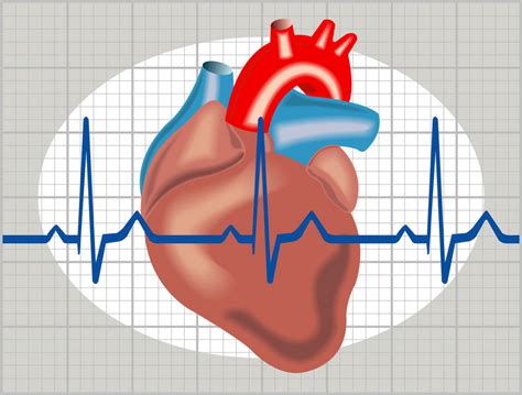 cardiomiopatia takotsubo sindromul inimii frânte