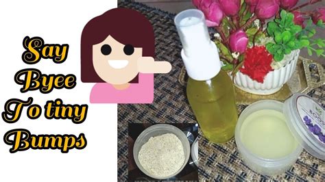 7 Days Challenge Treat Tiny Bumps On Your Face How To Treat Milia