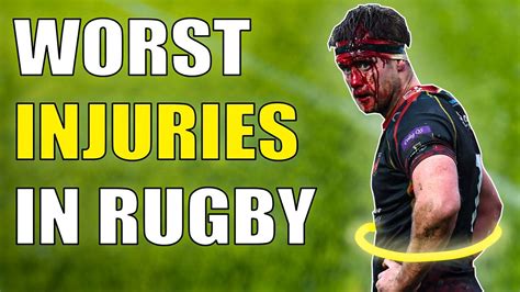 Rugby Worst Injuries Ever 1080phd Youtube