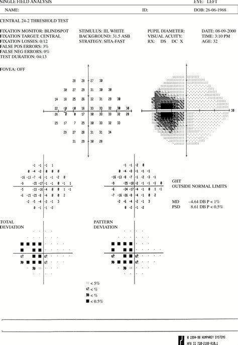 Unilateral Enlargement Of The Blind Spot A Diagnostic