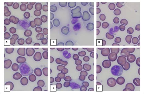 Representative Monocytes A E And Lymphocyte F In Blood Smears
