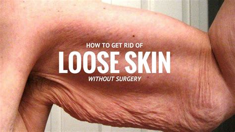 How To Tighten Extra Loose Saggy Skin Without Surgery After Weight Loss Remedies Guaranteed