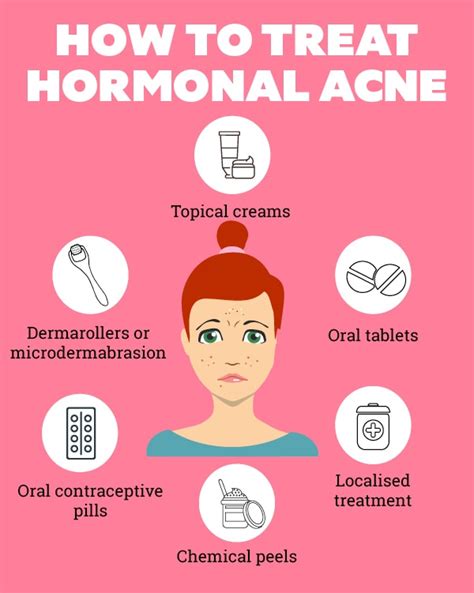 What Is Hormonal Acne And How To Deal With It Be Beautiful India