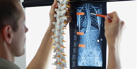 What You Should Know About Spinal Cord Injuries Law Firm Article By