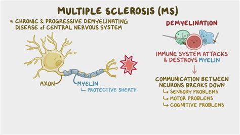 Disease Modifying Therapy For Multiple Sclerosis Nursing Pharmacology
