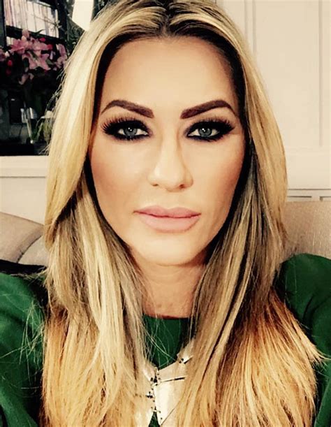 Real Housewives Of Cheshire Dawn Wards Shows Off Facelift Result Daily Star