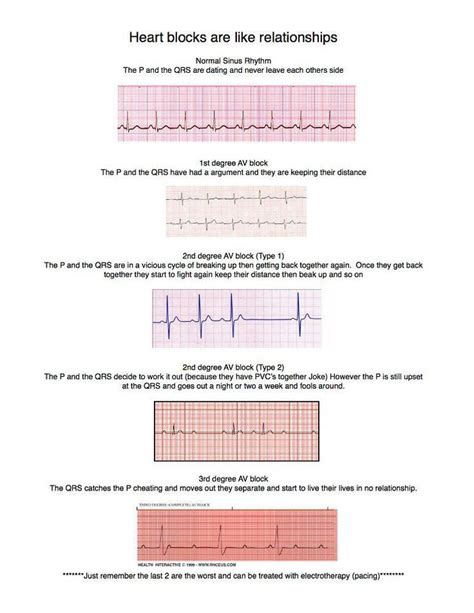 Pin On Acls Ecg And Pals