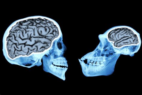 Why Is The Human Brain So Different From The Brains Of Closely Related