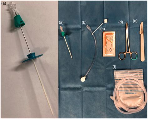 Establishing An Indwelling Peritoneal Catheter As A Standard Procedure