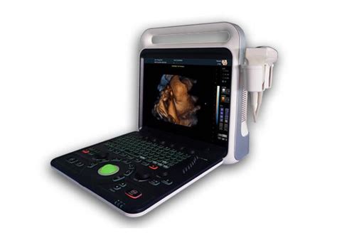 4d Ultrasound Machine Portable Ultrasound Scanner With 3d And Phased