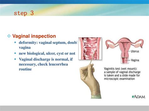 ppt gynecological history and physical examination powerpoint presentation id 4708639