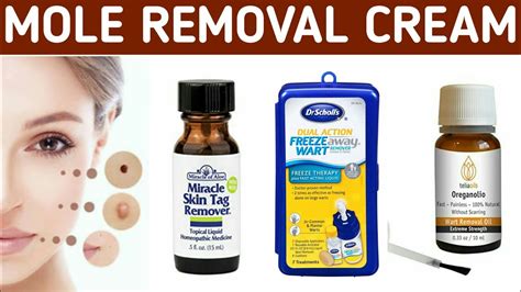 best mole skin tag warts removal creams in india youtube