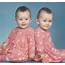 Monoamniotic Twins Are They In Your Genes
