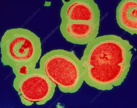 Mrsa Resistant Staphylococcus Bacteria Stock Image B2340067