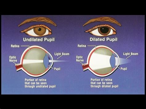 Pupil Dilation Chart Kesilprints