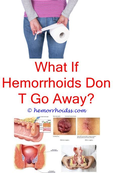 Do I Have Hemorrhoids What Are The Early Signs Of Hemorrhoidscan External Hem