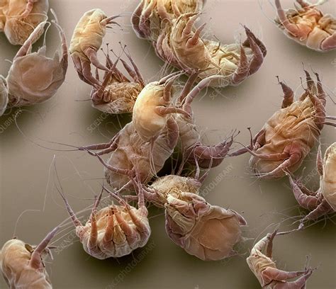Dust Mites Sem Stock Image F0027925 Science Photo Library