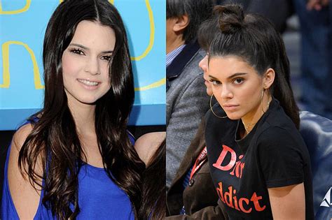 Did Kendall Jenner Get Plastic Surgery Model Calls Accusations Crazy