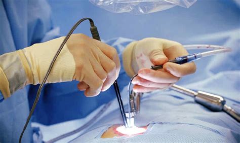 What Is And How Is Minimally Invasive Endoscopic Laser Surgery Of The