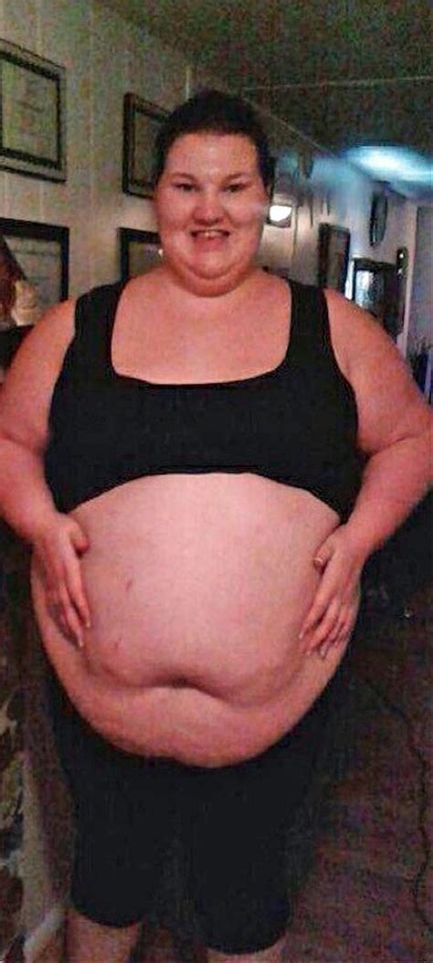 Woman Who Once Ate 11000 Calories Of Fast Food A Day Loses 17 Stone