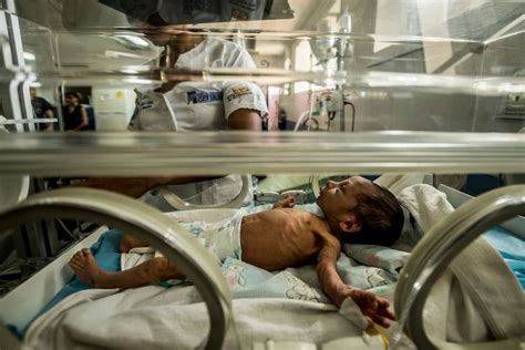 As Venezuela Collapses Its Children Are Dying Of Hunger The Seattle