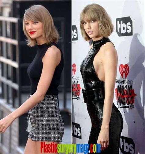Taylor Swifts Bum Taylor Swift Butt Implant Finally Confirmed