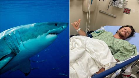 California Man Attacked By Great White Shark Recounts Terrifying Moment